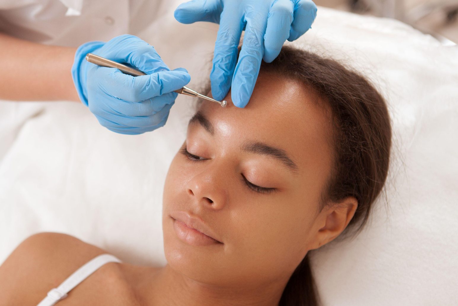 Teen Acne Facial Image