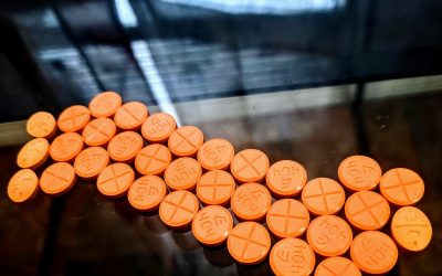 Does Adderall Cause Acne?